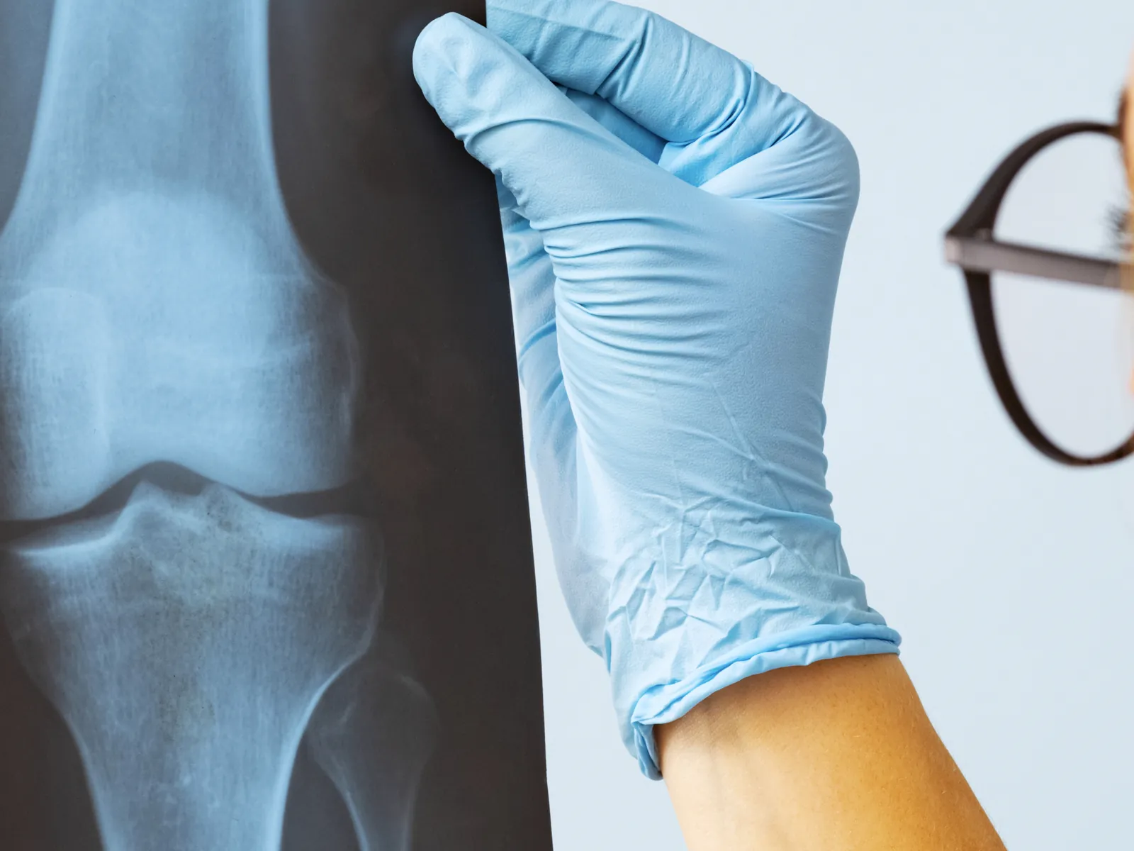 A gloved hand holding up a knee X-ray